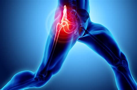 Durerea de genunchi: cauze, diagnostic, tratament
